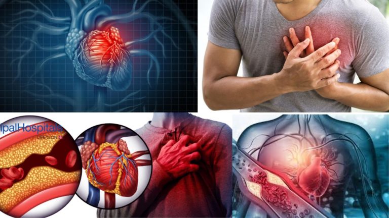 Heart Attack : It’s Causes & Solution