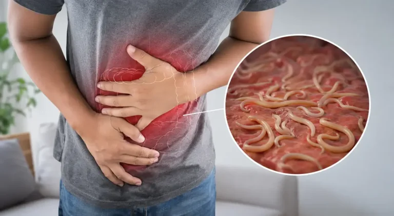 Intestinal Parasites: Symptoms, Causes, and Treatment